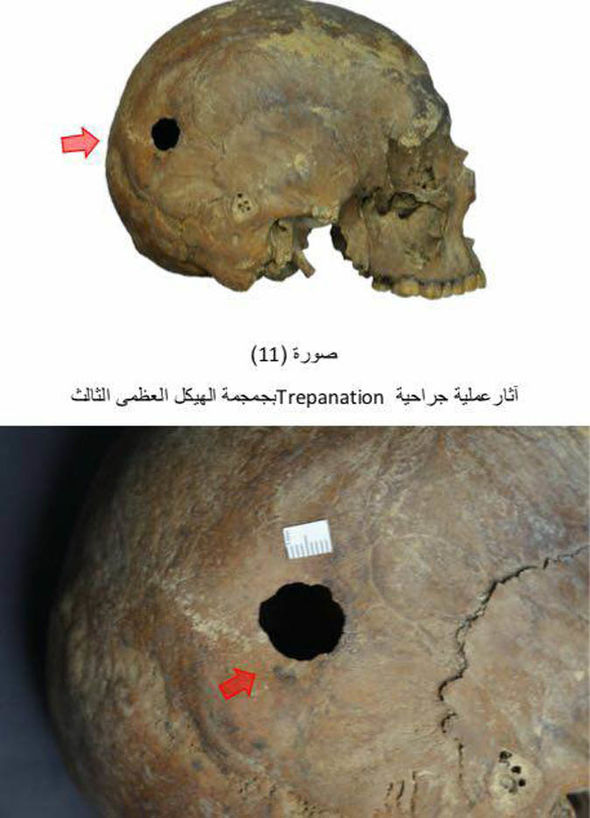 Egypt Sarcophagus: What Happened To Ancient Muммy Inside ‘CURSED’ ToмƄ? - T-News